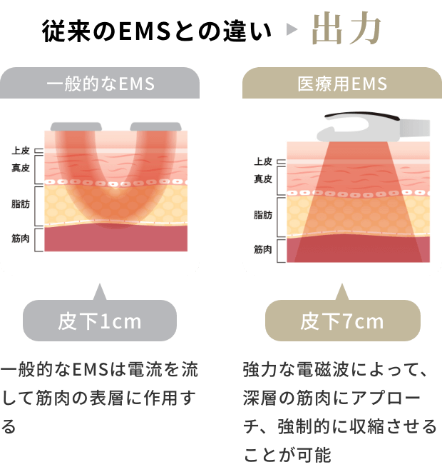 従来のEMSとの違いは出力。一般的なEMSは電流を流して筋肉の表層に作用する。医療用EMSでは強力な電磁波によって、深層の筋肉にアプローチ、強制的に収縮させることが可能。