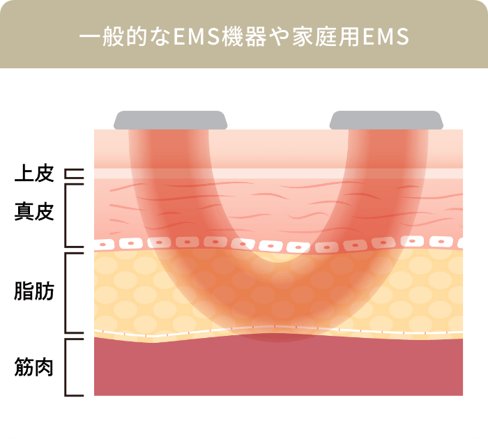 一般的なEMS機器や家庭用EMS